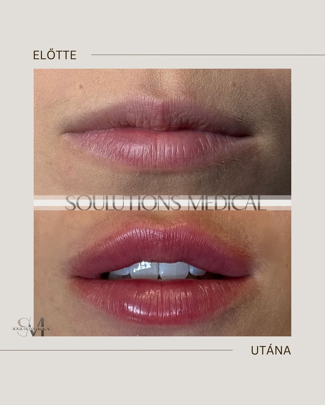 Beige Brown Neutral Before + After Poster - 6