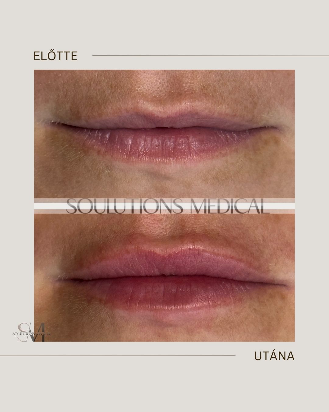 Beige Brown Neutral Before + After Poster.zip - 1