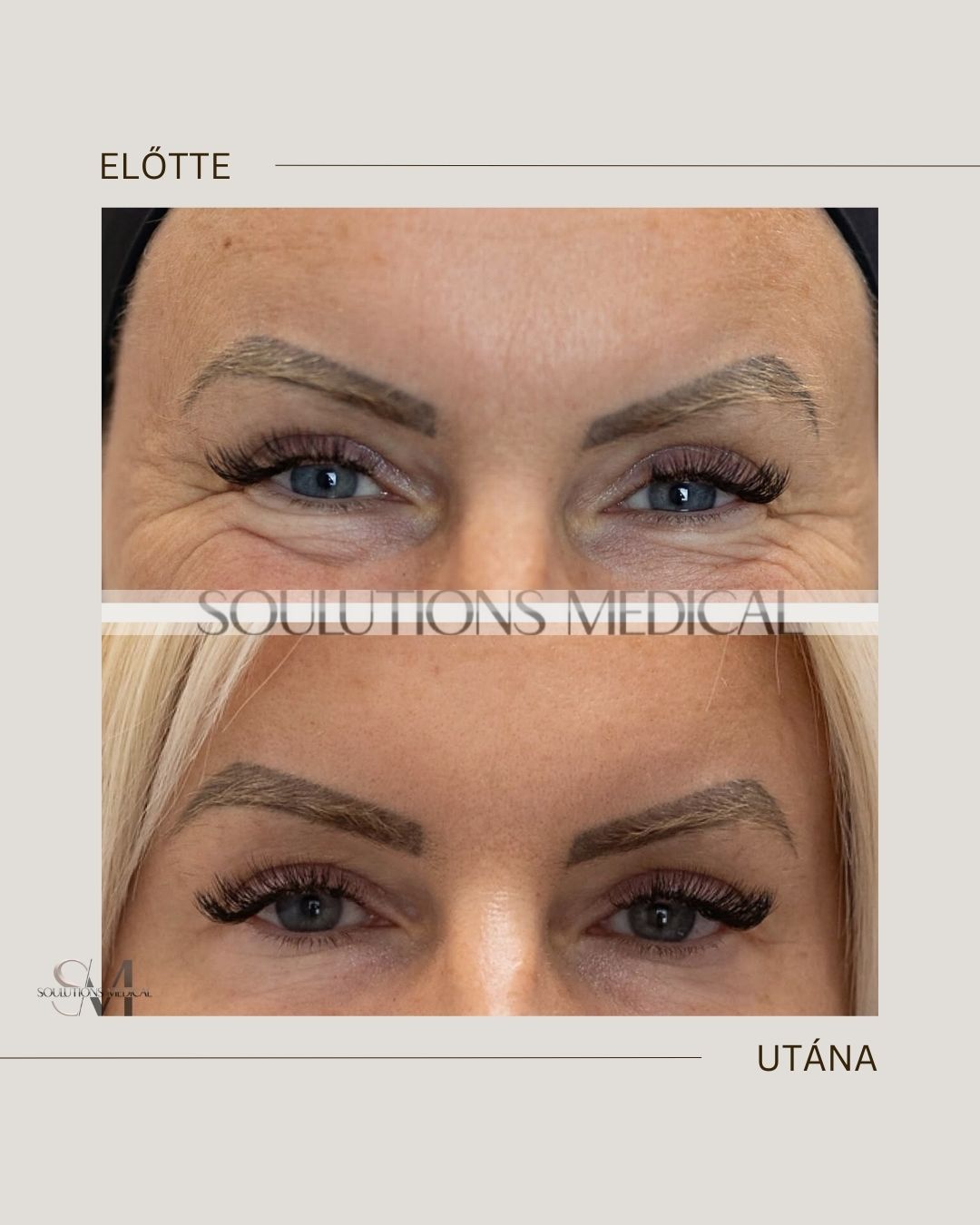 Beige Brown Neutral Before + After Poster.zip - 10