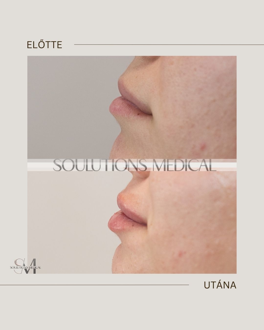 Beige Brown Neutral Before + After Poster.zip - 12