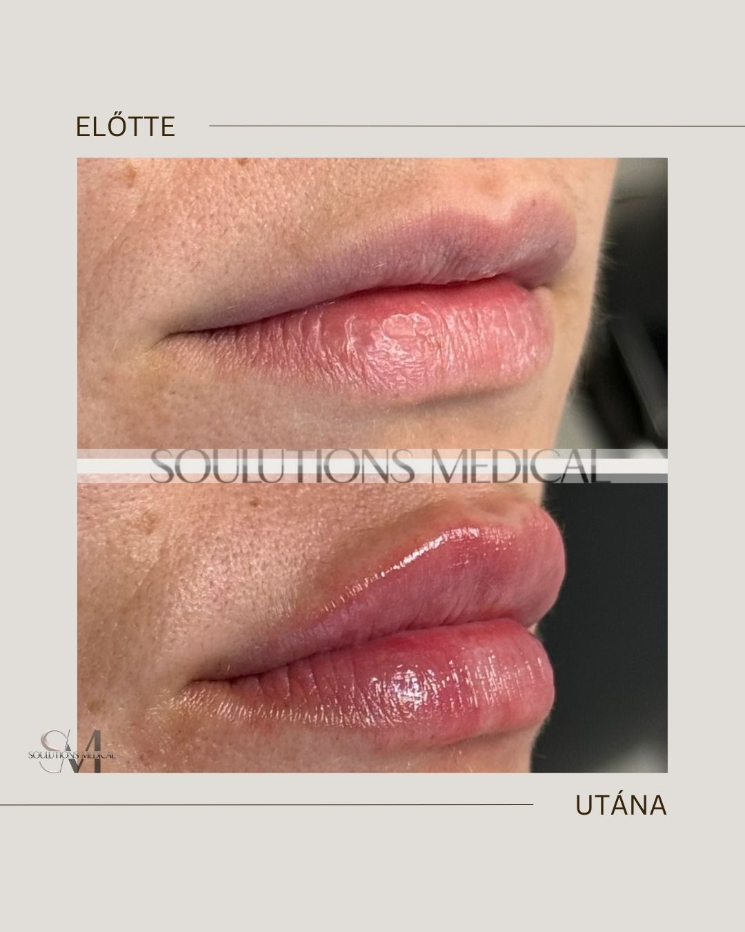 Beige Brown Neutral Before + After Poster.zip - 14