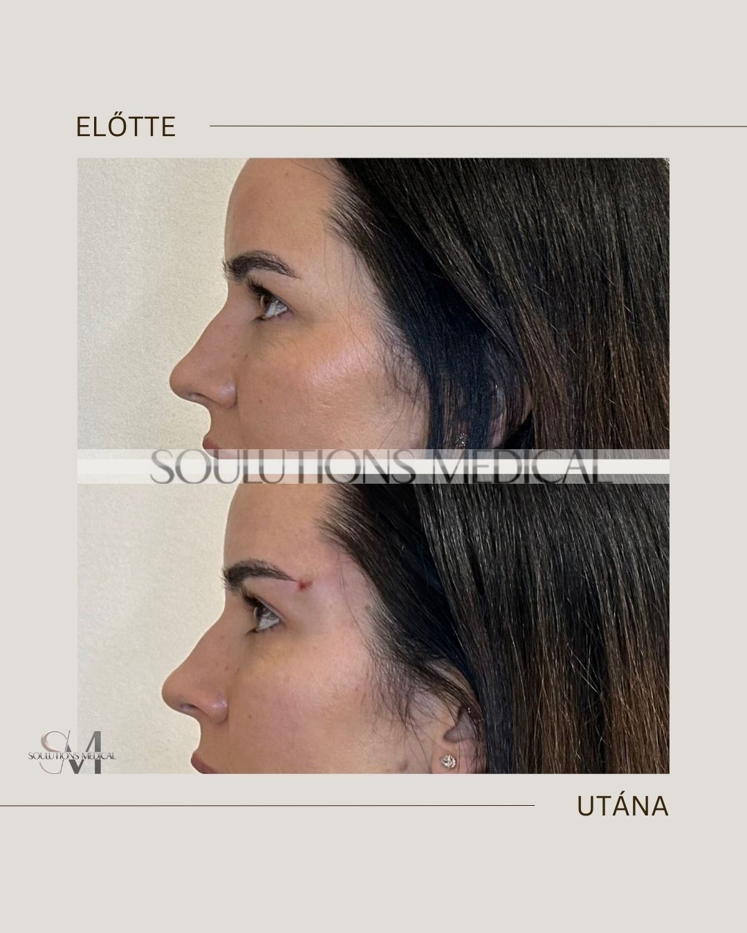 Beige Brown Neutral Before + After Poster.zip - 16