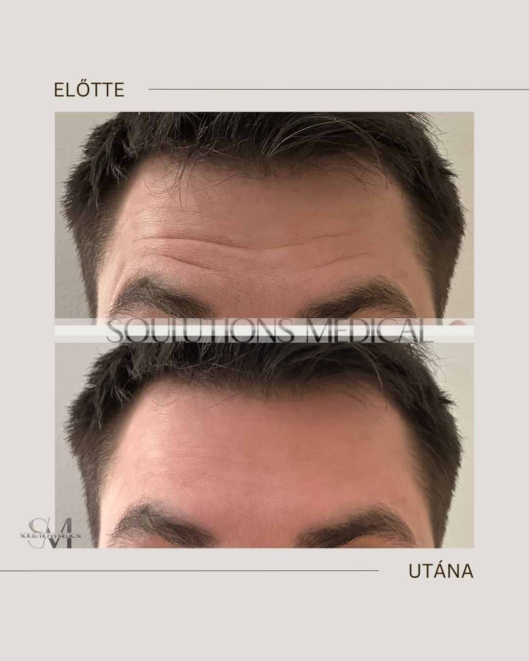 Beige Brown Neutral Before + After Poster.zip - 17