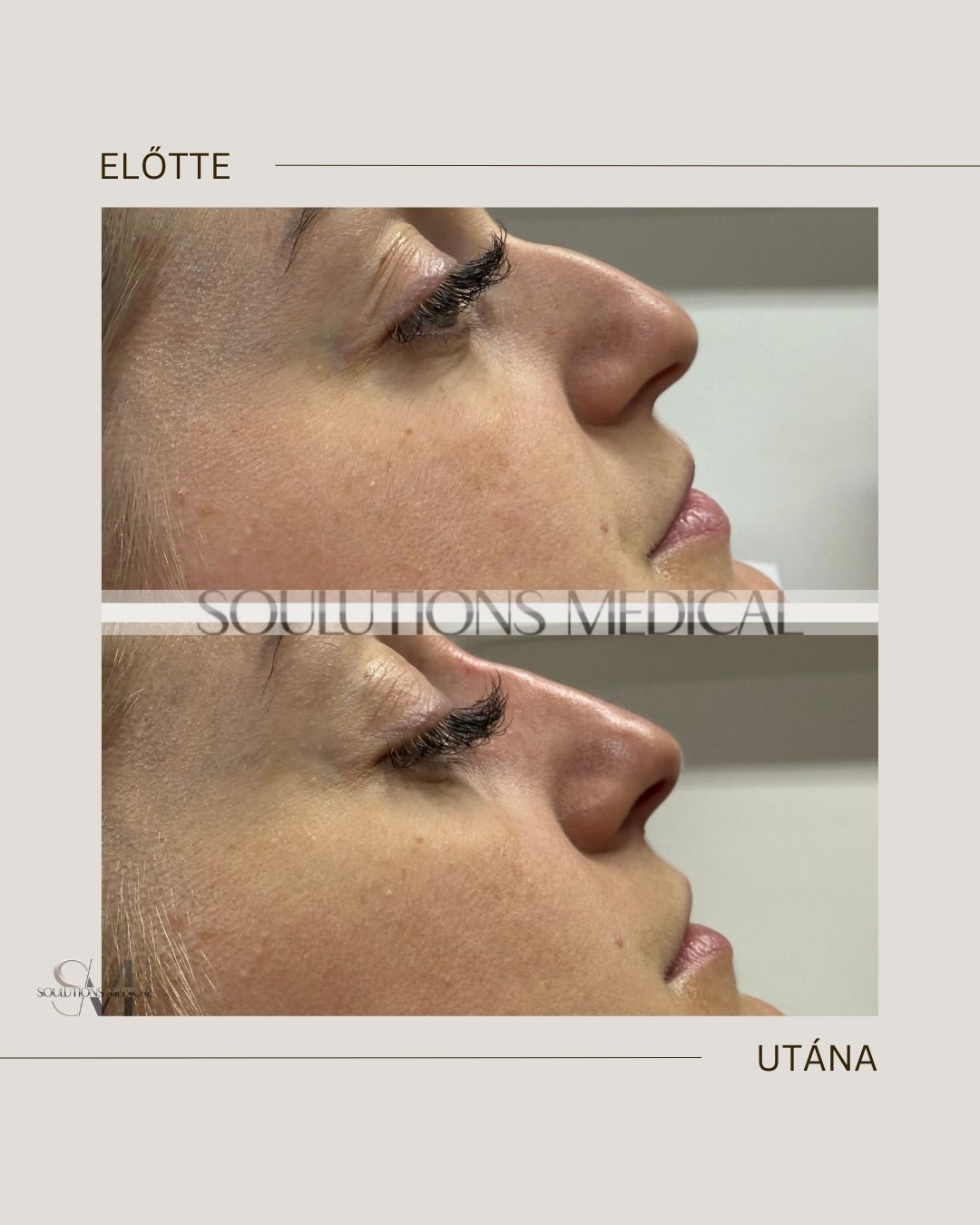 Beige Brown Neutral Before + After Poster.zip - 18