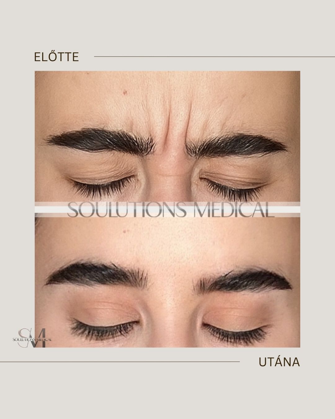 Beige Brown Neutral Before + After Poster.zip - 20