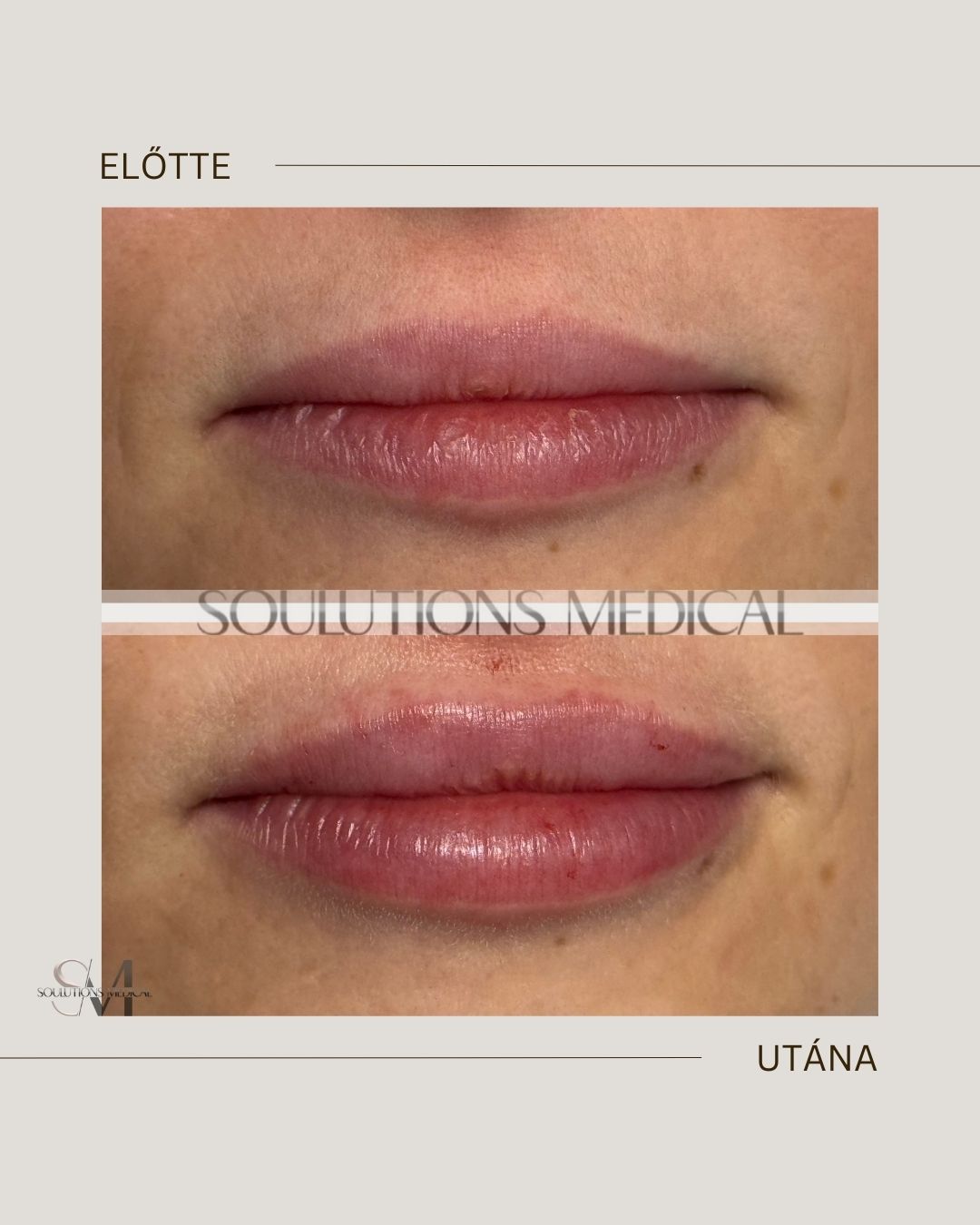 Beige Brown Neutral Before + After Poster.zip - 6