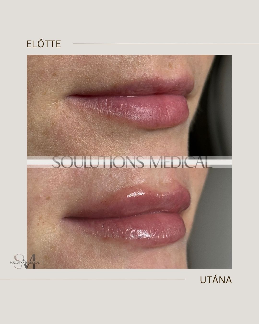 Beige Brown Neutral Before + After Poster.zip - 7