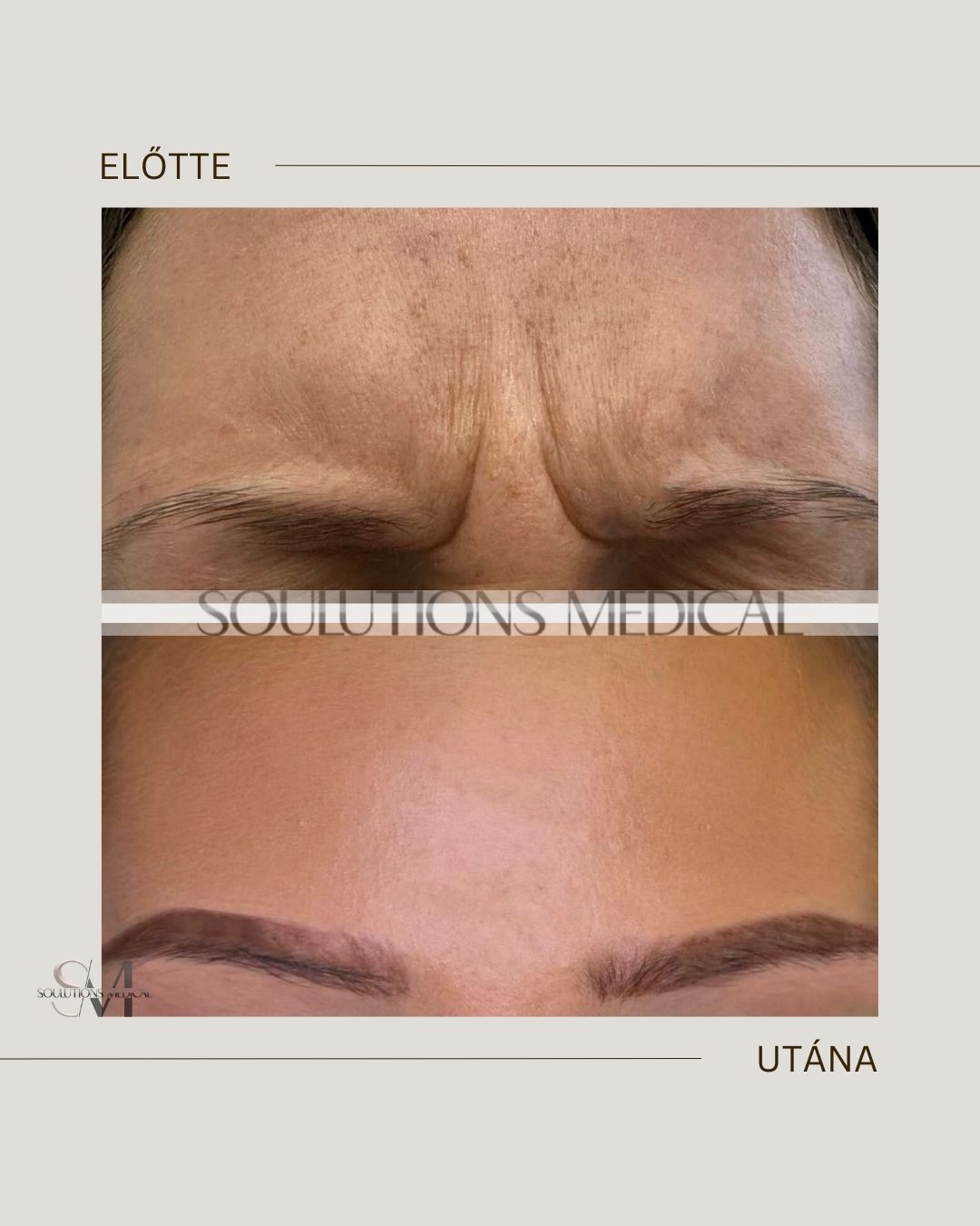 Beige Brown Neutral Before + After Poster.zip - 8