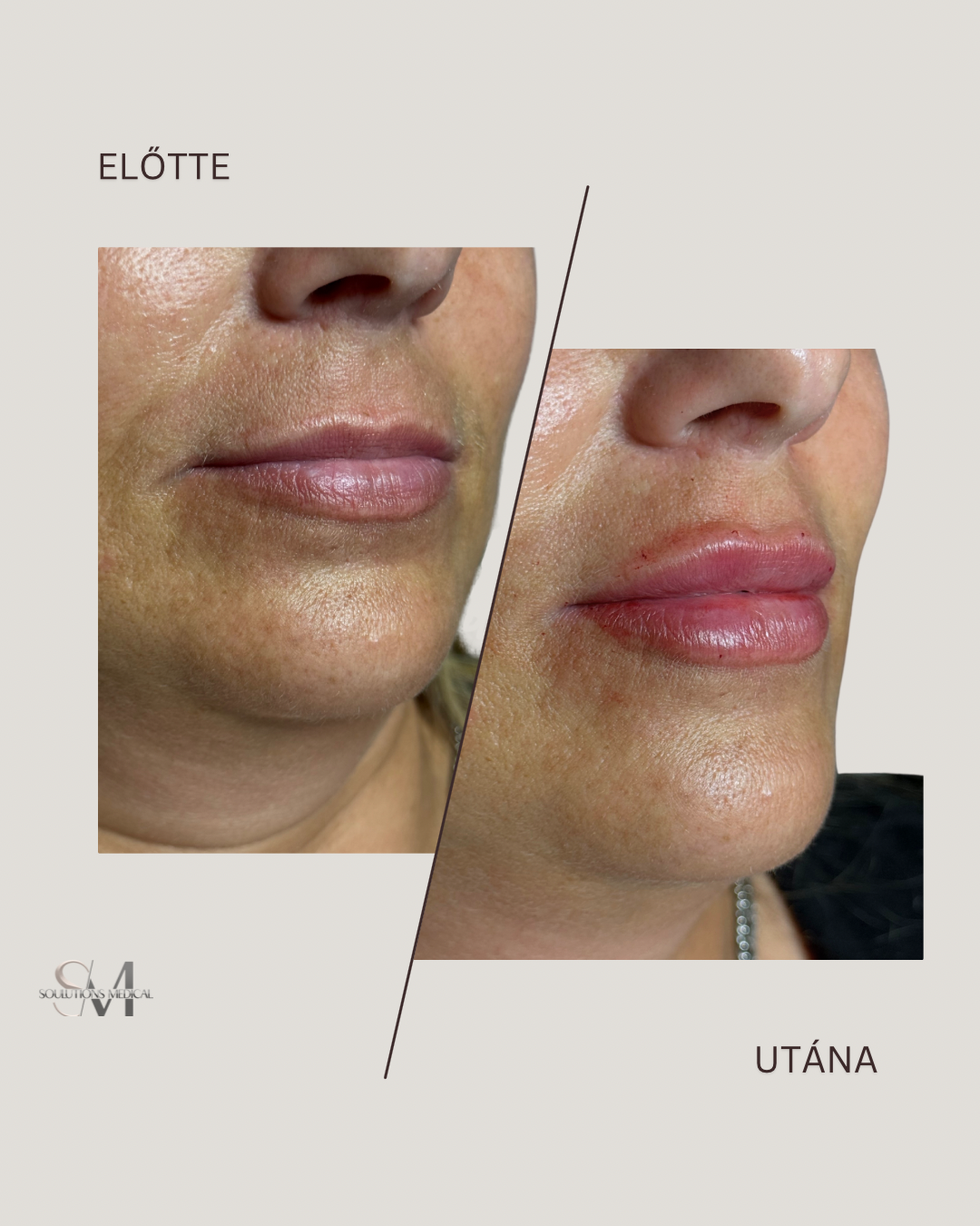 Brown Abstract Simple Photo Before and After Skincare Instagram Post - 1