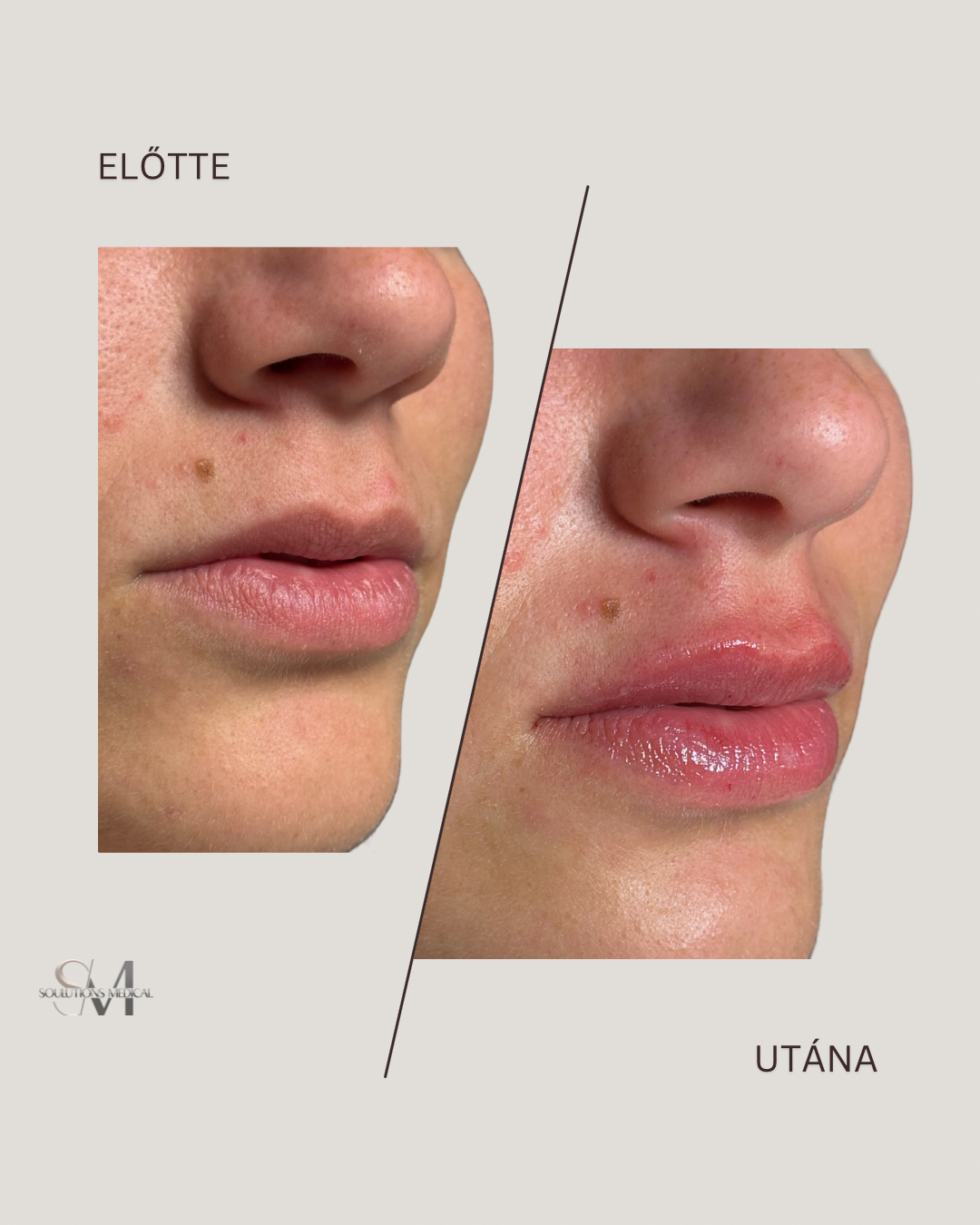 Brown Abstract Simple Photo Before and After Skincare Instagram Post - 2