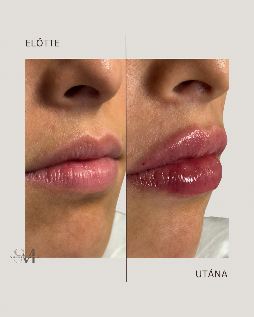 Brown Abstract Simple Photo Before and After Skincare Instagram Post - 3