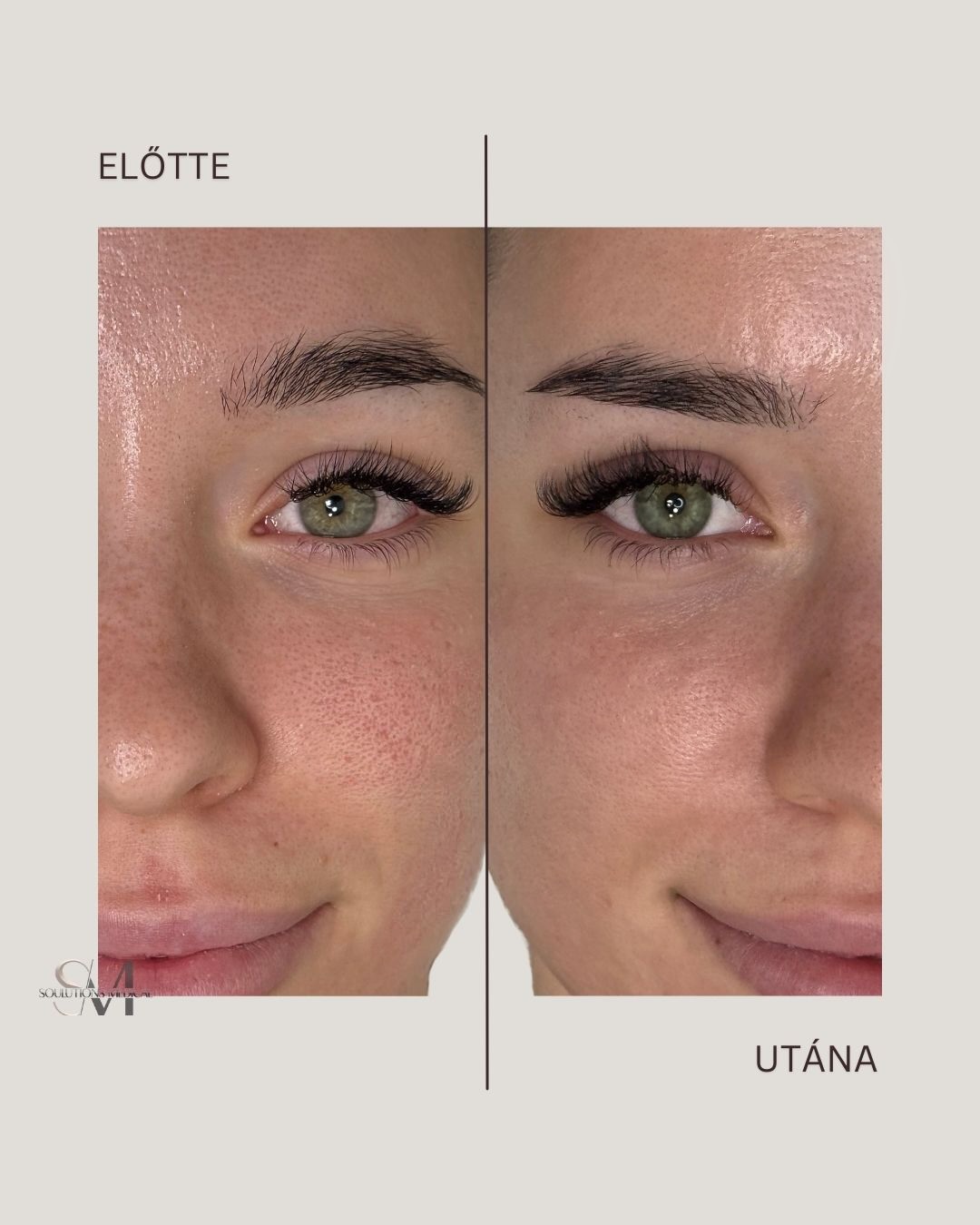 Brown Abstract Simple Photo Before and After Skincare Instagram Post (Instagram-bejegyzés (4:5)) - 3