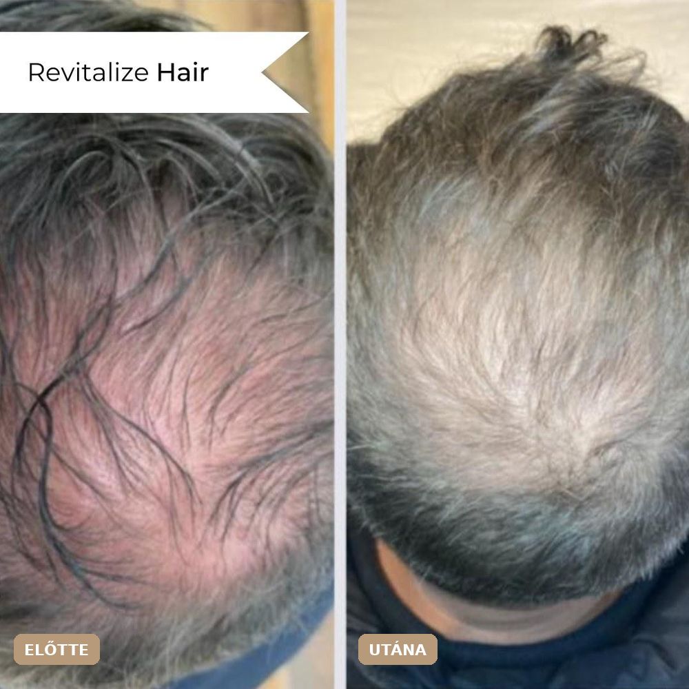 Revitalize előtte–utána: Revitalize Hair