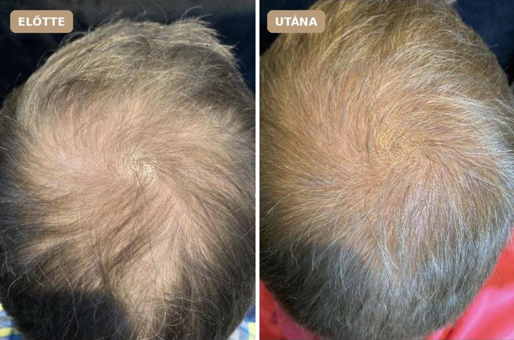 Revitalize előtte–utána: Revitalize Hair