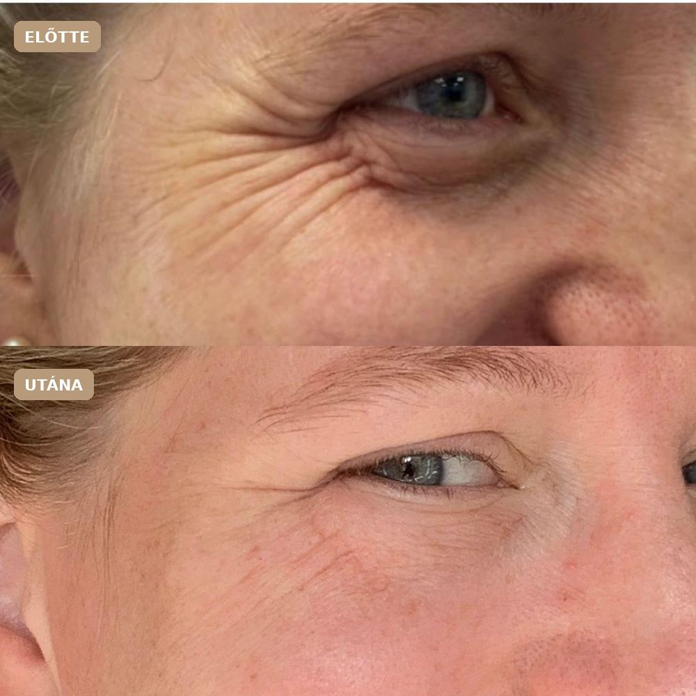 Revitalize előtte–utána: Revitalize Essence